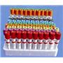 Vacuum Blood Collection Tubes and Other Disposable Products